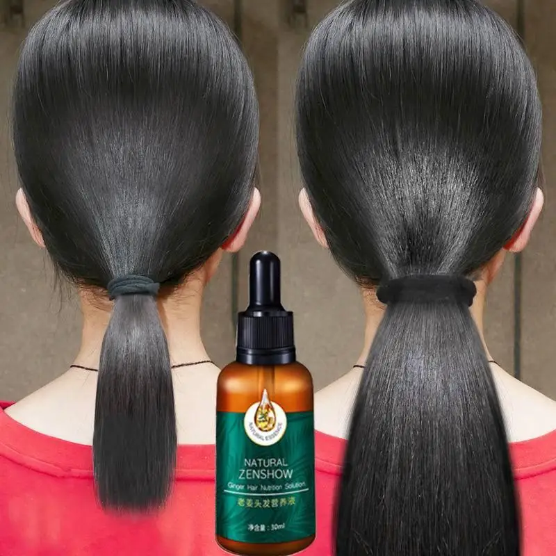 Hair Care Herbal Products - Óleo essencial do crescimento do cabelo