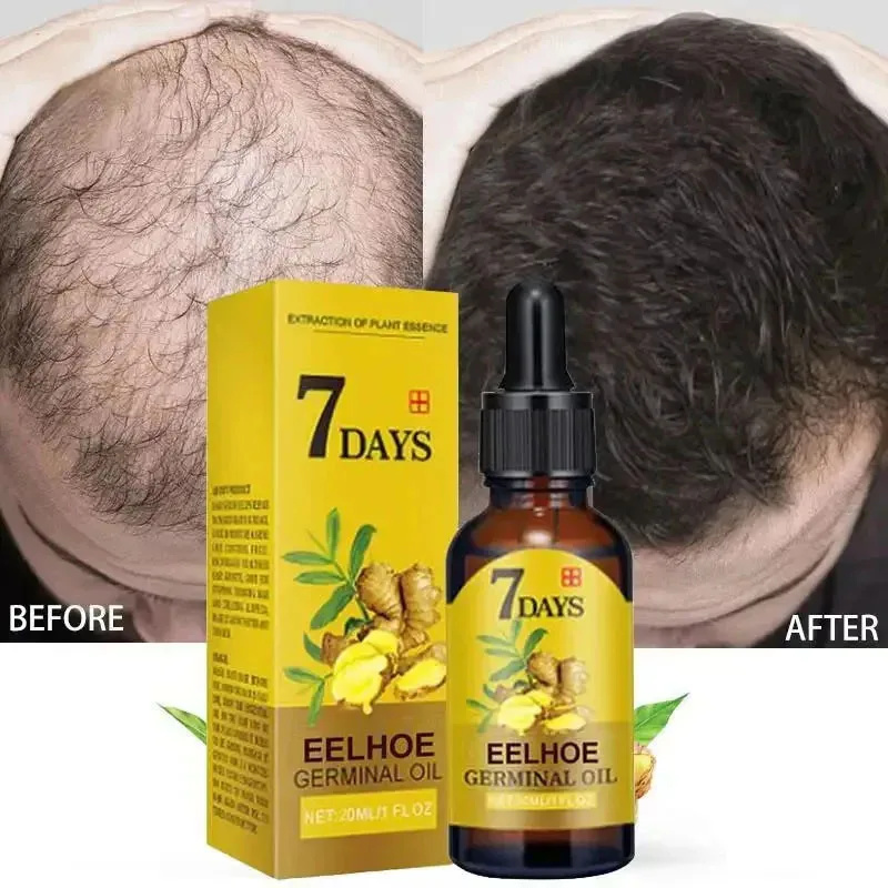 Hair Care Essential Oil Atomizing - Sérum de Crescimento Rápido de Cabelo