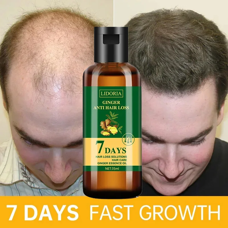 Óleo Essencial de Crescimento  - Hair Care Essential Oil Atomizing avaliação e preço