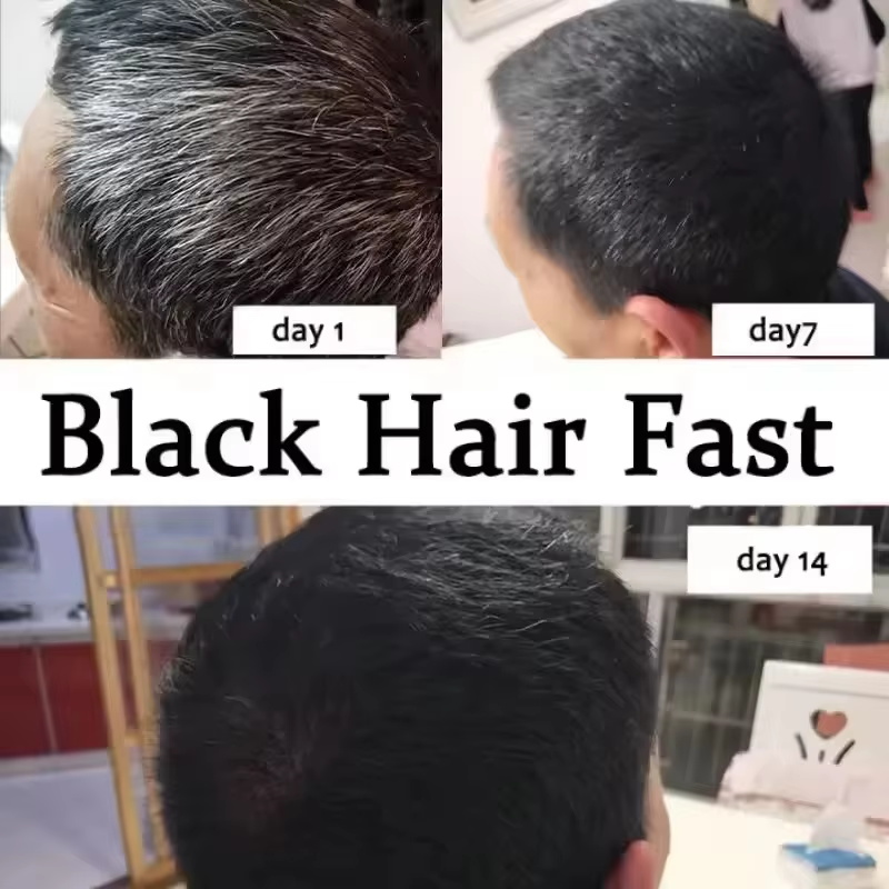 Sérum de Tratamento para Cabel - Hair Care Ginseng avaliação e preço