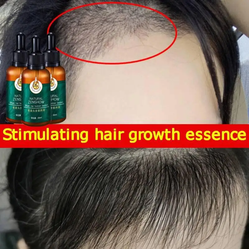 Óleo essencial do crescimento  - Hair Care Herbal Products avaliação e preço