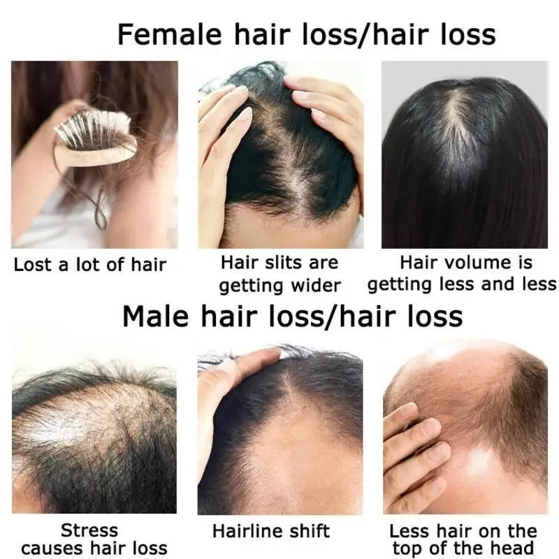 Óleo essencial do crescimento  - Hair Care Herbal Products avaliação e preço