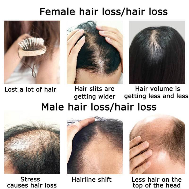 Óleo essencial de crescimento  - Hair Care Herbal Products avaliação e preço