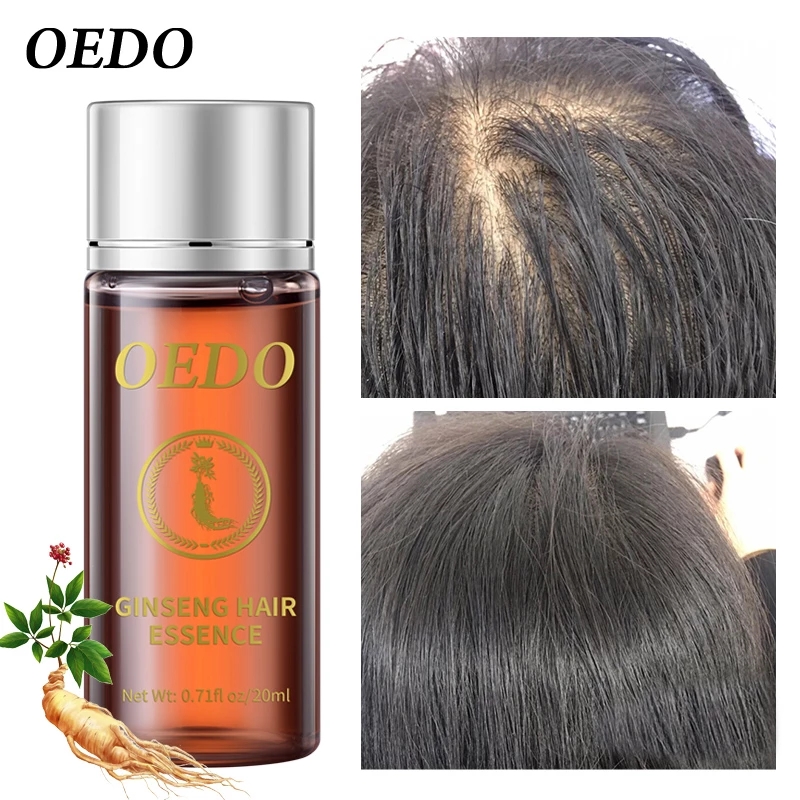 Essência de crescimento capila - Hair Care Ginseng avaliação e preço