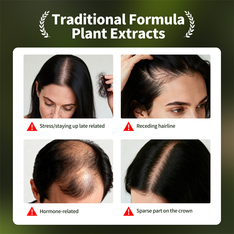 Conjunto de crescimento capila - Hair Care Herbal avaliação e preço
