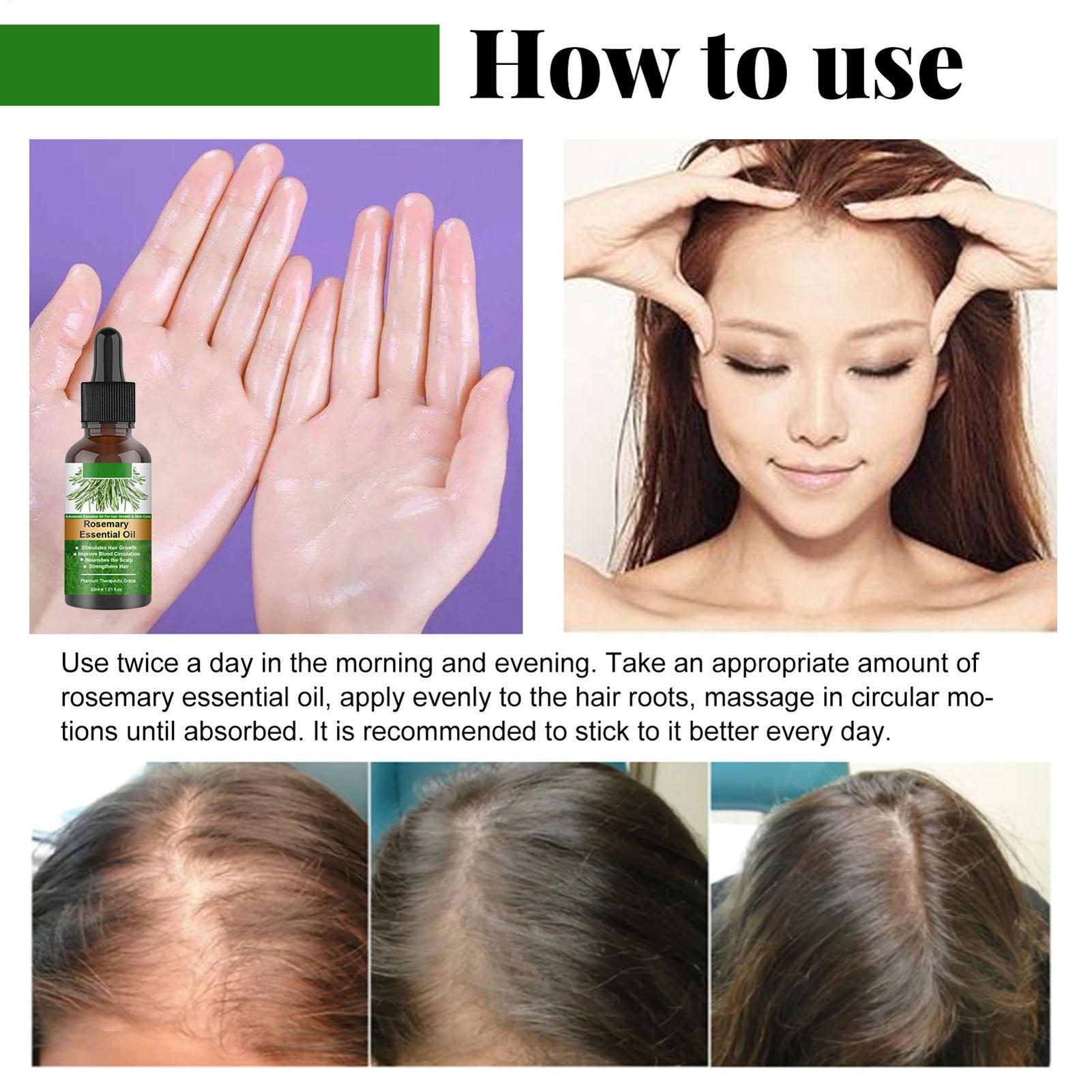 Óleo Essencial de Alecrim para - Hair Care Natural Products avaliação e preço