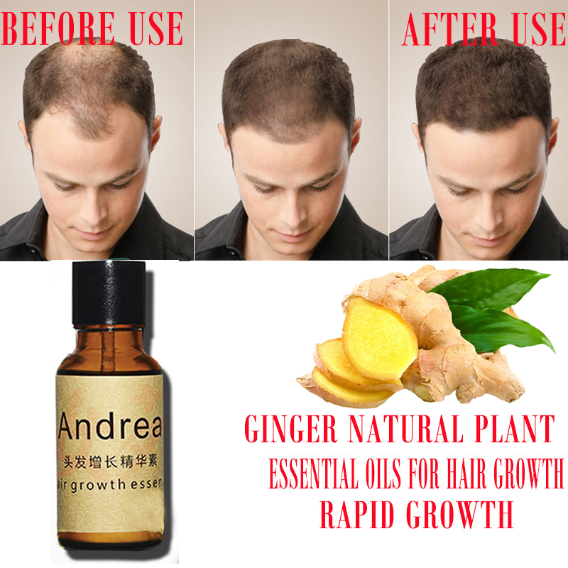 2/5/10 pçs andrea crescimento  - Hair Care Herbal avaliação e preço