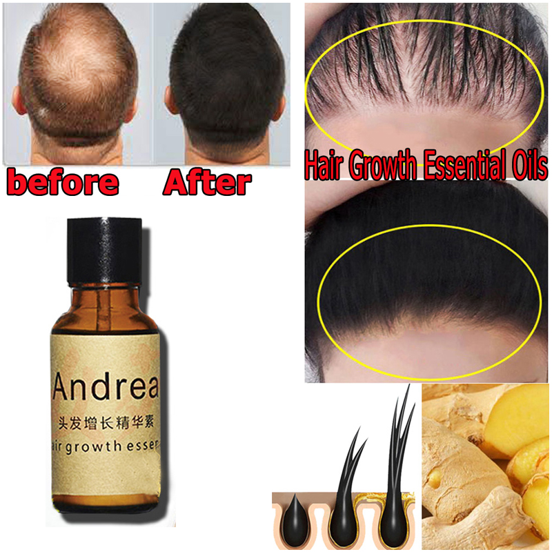 2/5/10 pçs andrea crescimento  - Hair Care Herbal avaliação e preço